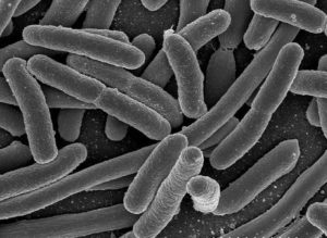 E. coli, a common intestinal bacterium