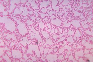 Bacteroides bacteria